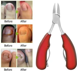 IGOODS Nagelriem Knipper - Professionele Teennagelknipper Cutter Tang - RVS - Zwart - Dikke Nagels Tool Gesneden Nagel - Teen Trimmer -Cosmetica Winkel 1200x1106