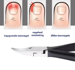 Medies - Professionele Zware Nageltang Voor Teennagels | Nagelknipper Teennagels | Ingegroeide Teennagel | Kalknagel | Harde Teennagels | Nagelschaar | Pedicure - Ingebouwde Veren -Cosmetica Winkel 1200x1113