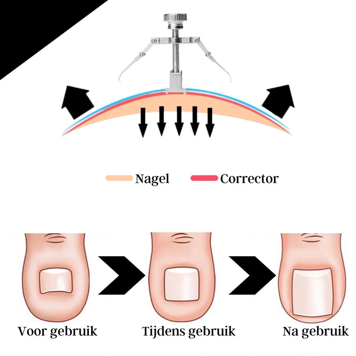 Merkloos STARMAN 7-delige Pedicure En Manicure Set - Nagelknipper - Pedicureset - Nagelvijl - Nageltang - Kalknagel - Teennagelknipper 6 Merkloos STARMAN 7-delige Pedicure En Manicure Set - Nagelknipper - Pedicureset - Nagelvijl - Nageltang - Kalknagel - Teennagelknipper - Afbeelding 6