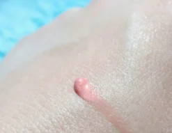 Biodermal Sun Lipbalm SPF25 - Tube 12 Ml - Natural Pink - Lippenbalsem -Cosmetica Winkel 1200x927 2